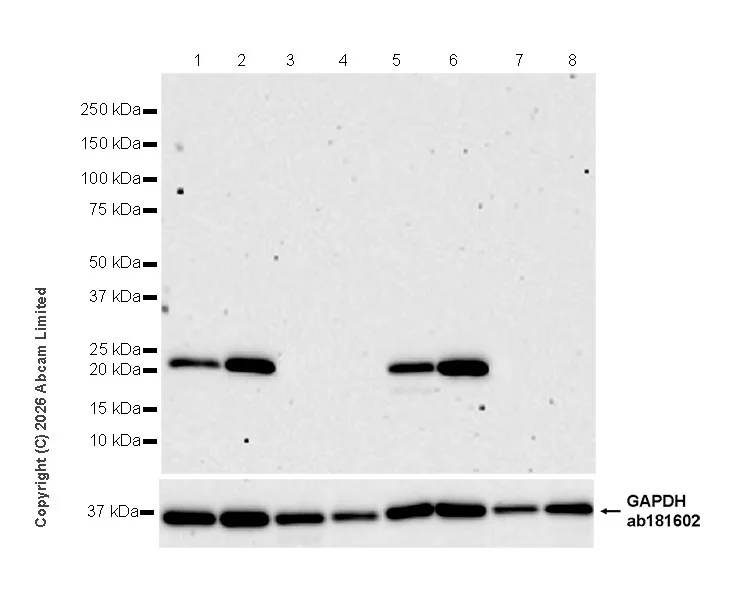 Western blot - Anti-TAGLN3 antibody [EPR31032-506] (AB326940)
