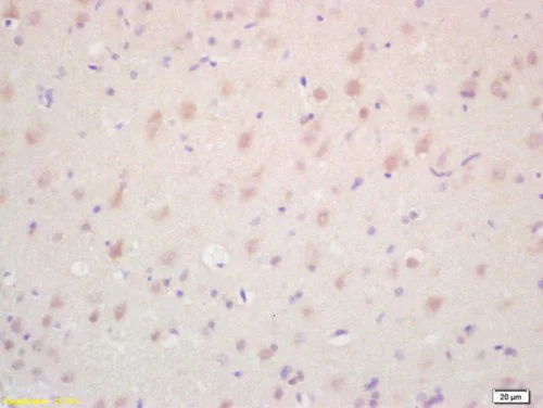 Immunohistochemistry (Formalin/PFA-fixed paraffin-embedded sections) - Anti-TAK1 antibody (AB217545)