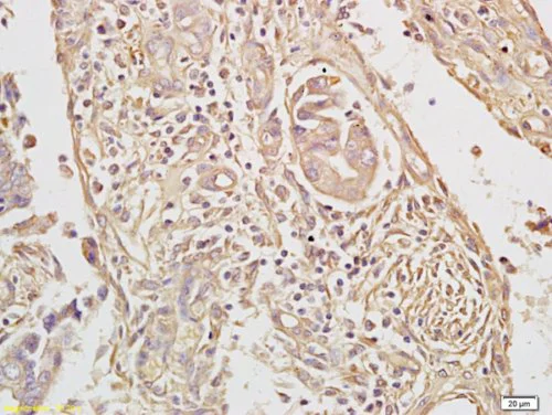 Immunohistochemistry (Formalin/PFA-fixed paraffin-embedded sections) - Anti-TAK1 antibody (AB217545)