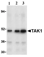 Western blot - Anti-TAK1 antibody (AB25879)