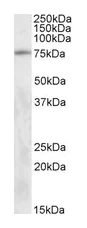 Western blot - Anti-TAK1 antibody (AB50431)