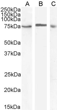 Western blot - Anti-TAK1 antibody (AB50431)