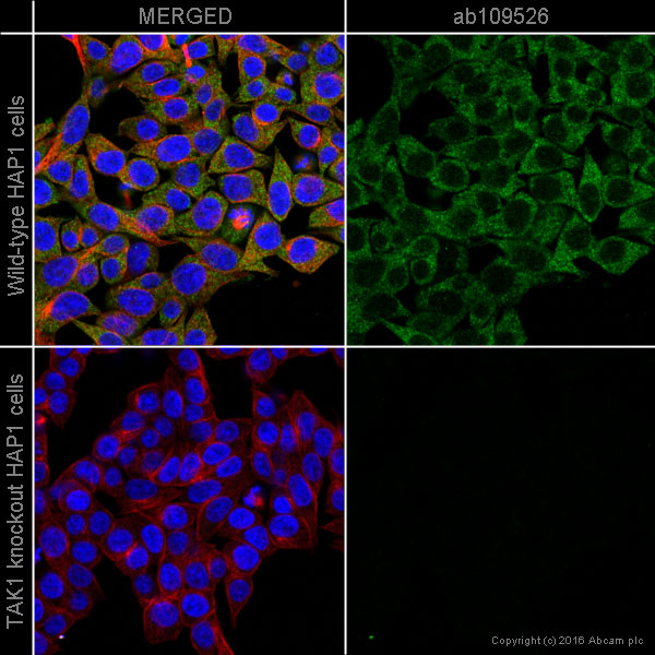 Immunocytochemistry/ Immunofluorescence - Anti-TAK1 antibody [EPR5984] (AB109526), expandable thumbnail