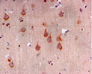 Immunohistochemistry (Formalin/PFA-fixed paraffin-embedded sections) - Anti-TAK1 antibody [EPR5984] (ab109526), expandable thumbnail