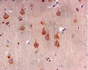 Immunohistochemistry (Formalin/PFA-fixed paraffin-embedded sections) - Anti-TAK1 antibody [EPR5984] (AB109526)