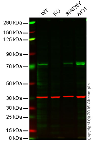 Western blot - Anti-TAK1 antibody [EPR5984] (AB109526), expandable thumbnail