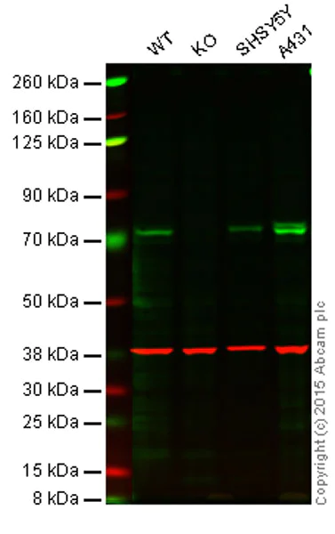 Western blot - Anti-TAK1 antibody [EPR5984] (AB109526)