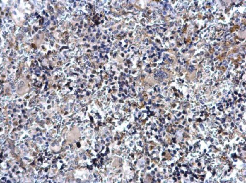 Immunohistochemistry (Formalin/PFA-fixed paraffin-embedded sections) - Anti-Tal1 antibody (AB155195), expandable thumbnail