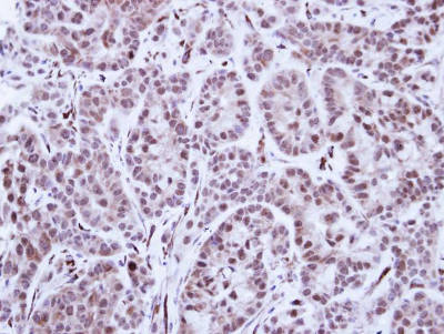Immunohistochemistry (Formalin/PFA-fixed paraffin-embedded sections) - Anti-Tal1 antibody (AB155195), expandable thumbnail