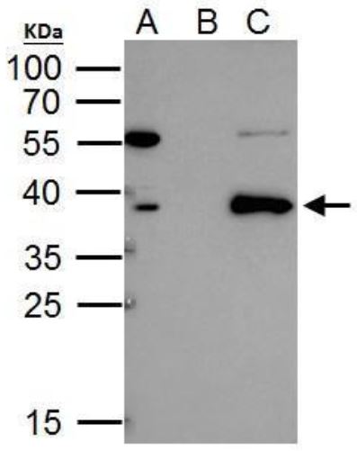 Immunoprecipitation - Anti-Tal1 antibody (AB155195), expandable thumbnail