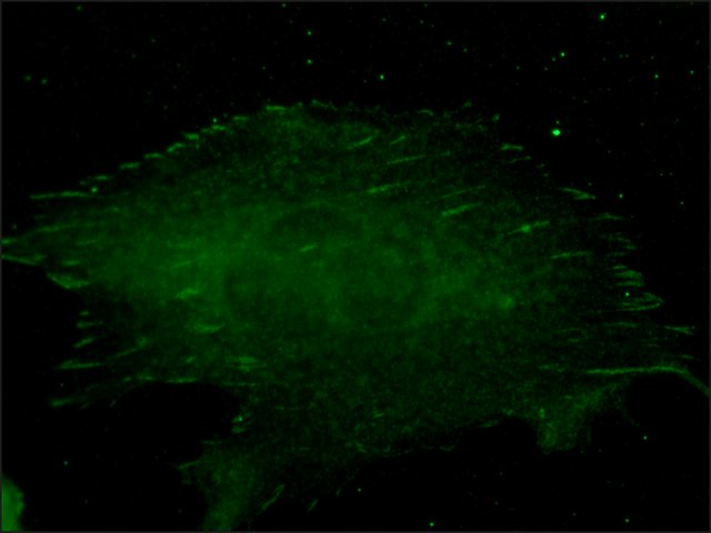 Immunocytochemistry/ Immunofluorescence - Anti-Talin 1 and 2 antibody [8D4] (AB11188), expandable thumbnail