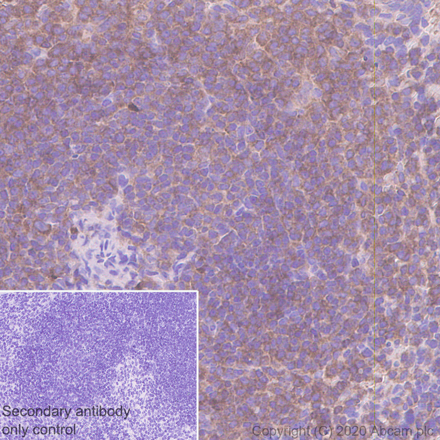 Immunohistochemistry (Formalin/PFA-fixed paraffin-embedded sections) - Anti-Talin 1 antibody [97H6] (AB108480), expandable thumbnail
