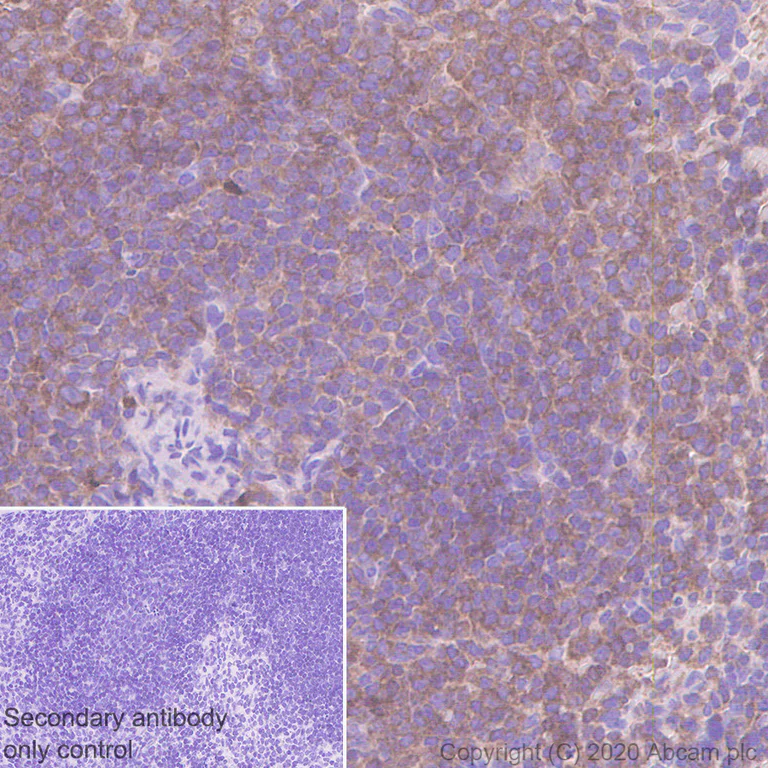 Immunohistochemistry (Formalin/PFA-fixed paraffin-embedded sections) - Anti-Talin 1 antibody [97H6] (AB108480)