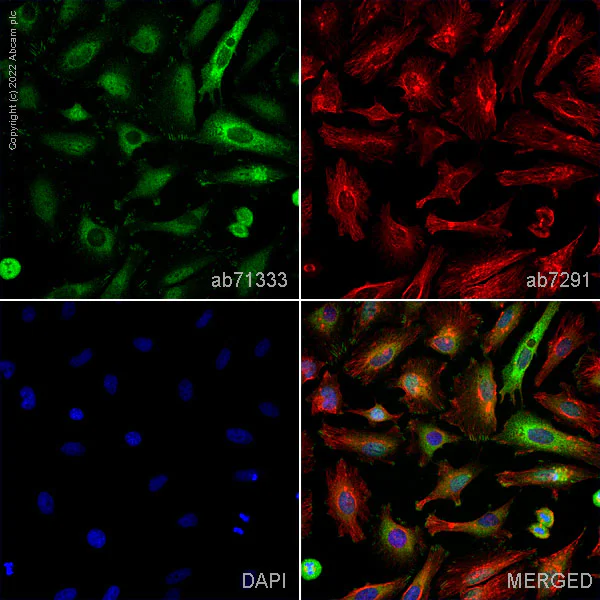 Immunocytochemistry/ Immunofluorescence - Anti-Talin 1 antibody (AB71333)
