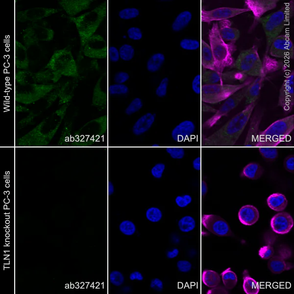 Immunocytochemistry/ Immunofluorescence - Anti-Talin 1 antibody [EPR29641-30] - BSA and Azide free (AB327430)