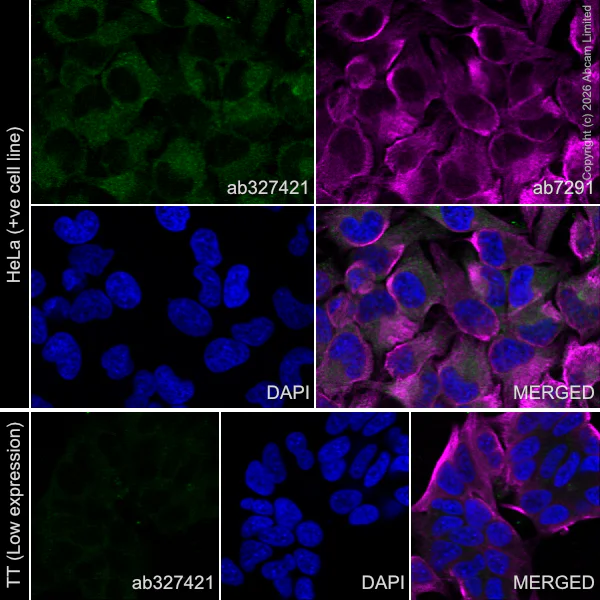 Immunocytochemistry/ Immunofluorescence - Anti-Talin 1 antibody [EPR29641-30] - BSA and Azide free (AB327430)