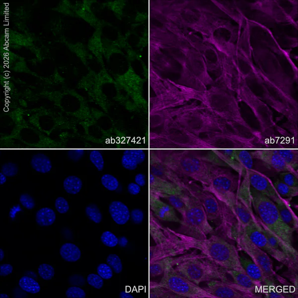 Immunocytochemistry/ Immunofluorescence - Anti-Talin 1 antibody [EPR29641-30] - BSA and Azide free (AB327430)