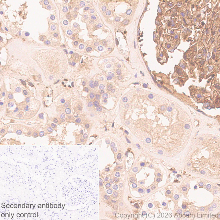 Immunohistochemistry (Formalin/PFA-fixed paraffin-embedded sections) - Anti-Talin 1 antibody [EPR29641-30] - BSA and Azide free (AB327430)