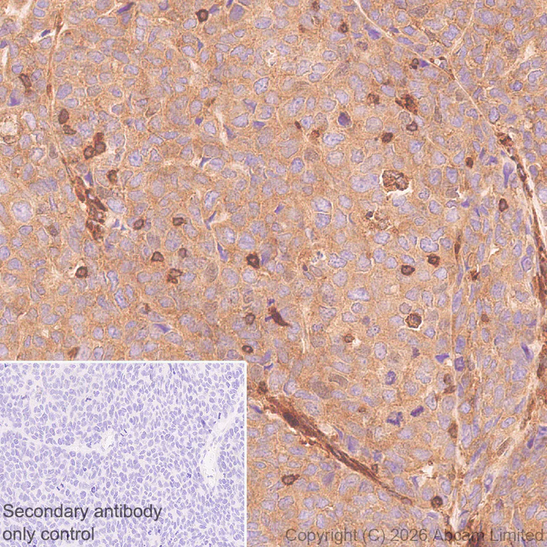 Immunohistochemistry (Formalin/PFA-fixed paraffin-embedded sections) - Anti-Talin 1 antibody [EPR29641-30] - BSA and Azide free (AB327430)