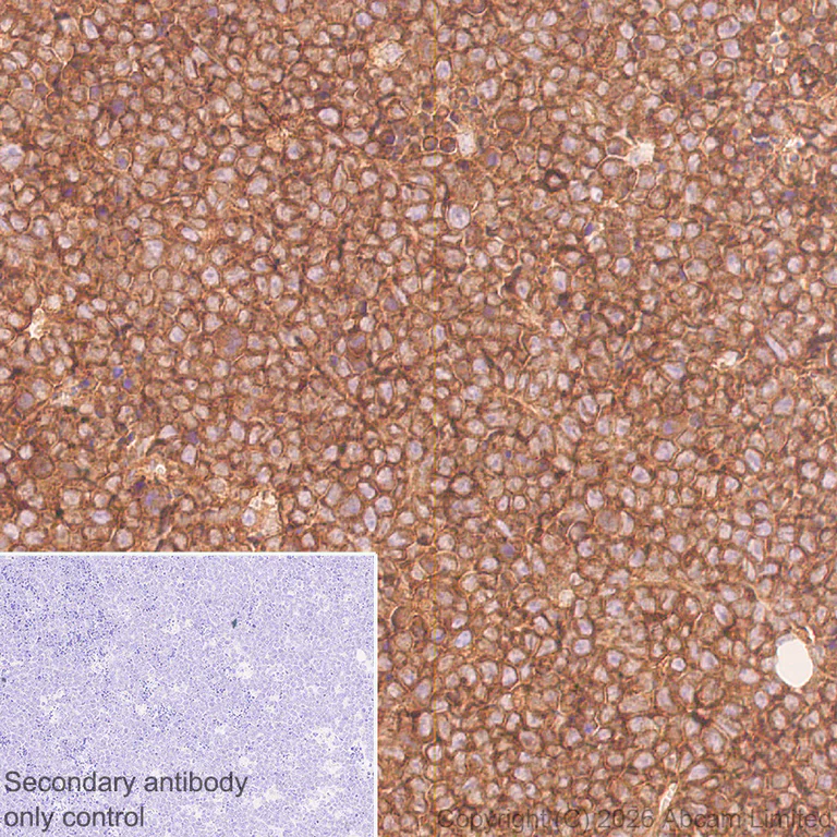 Immunohistochemistry (Formalin/PFA-fixed paraffin-embedded sections) - Anti-Talin 1 antibody [EPR29641-30] - BSA and Azide free (AB327430)