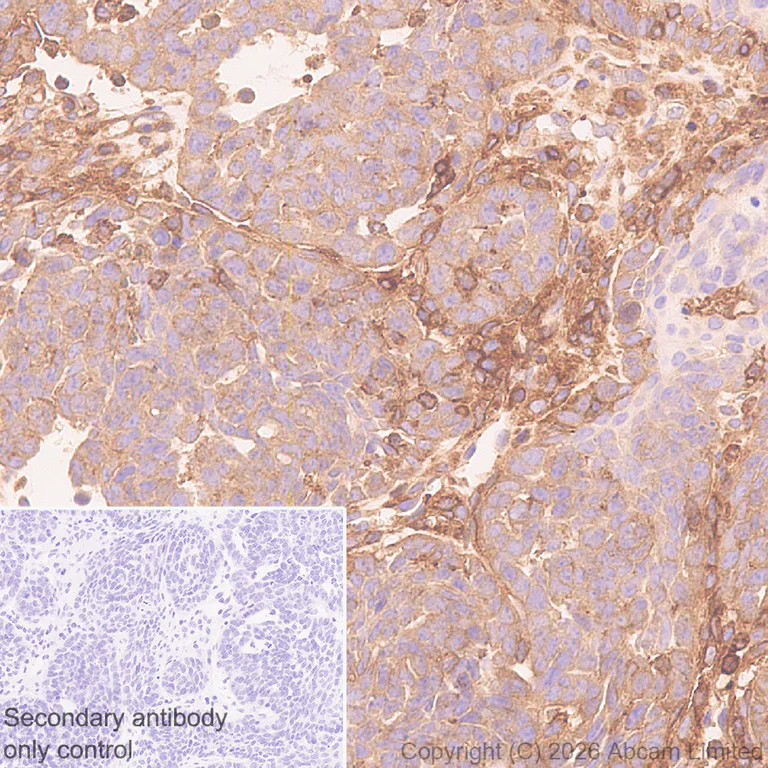 Immunohistochemistry (Formalin/PFA-fixed paraffin-embedded sections) - Anti-Talin 1 antibody [EPR29641-30] - BSA and Azide free (AB327430)