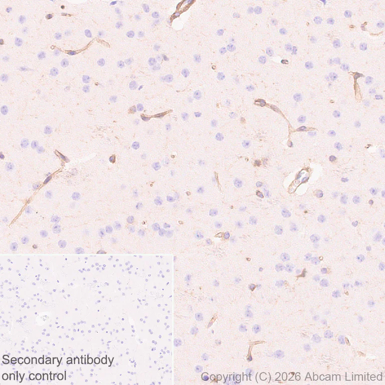 Immunohistochemistry (Formalin/PFA-fixed paraffin-embedded sections) - Anti-Talin 1 antibody [EPR29641-30] - BSA and Azide free (AB327430)