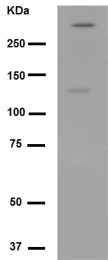 Western blot - Anti-Talin 2 antibody [EPR2536(2)] (AB108967)