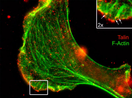 Immunocytochemistry/ Immunofluorescence - Anti-Talin antibody [8D4] (AB157808), expandable thumbnail