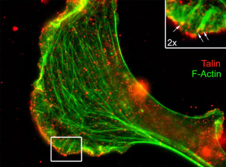 Immunocytochemistry/ Immunofluorescence - Anti-Talin antibody [8D4] (AB157808)