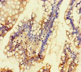 Immunohistochemistry (Formalin/PFA-fixed paraffin-embedded sections) - Anti-TALK1 antibody (AB234652)