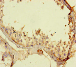 Immunohistochemistry (Formalin/PFA-fixed paraffin-embedded sections) - Anti-TALK1 antibody (AB234652)