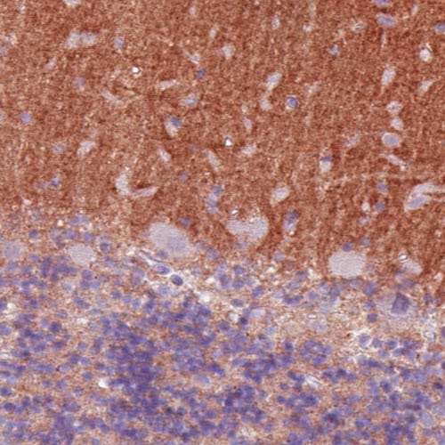 Immunohistochemistry (Formalin/PFA-fixed paraffin-embedded sections) - Anti-TALLA-1 antibody [CL0262] (AB211870), expandable thumbnail