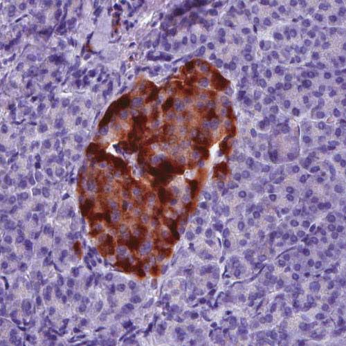 Immunohistochemistry (Formalin/PFA-fixed paraffin-embedded sections) - Anti-TALLA-1 antibody [CL0262] (AB211870), expandable thumbnail