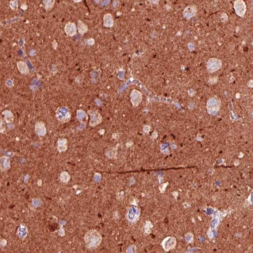 Immunohistochemistry (Formalin/PFA-fixed paraffin-embedded sections) - Anti-TALLA-1 antibody [CL0262] (AB211870), expandable thumbnail