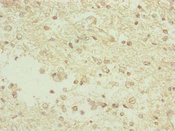 Immunohistochemistry (Formalin/PFA-fixed paraffin-embedded sections) - Anti-TAM41 antibody (AB230359)