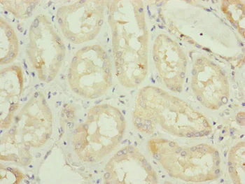 Immunohistochemistry (Formalin/PFA-fixed paraffin-embedded sections) - Anti-TAM41 antibody (AB230359)