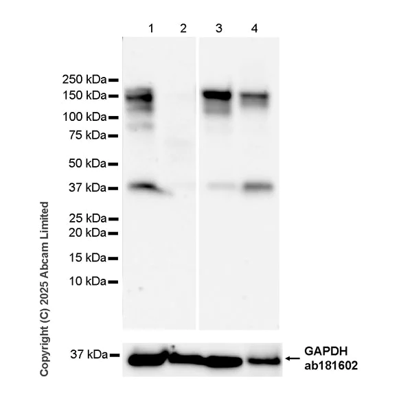 Western blot - Anti-Tankyrase 1/2 antibody [EPR29643-577] (AB324738)