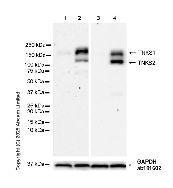 Western blot - Anti-Tankyrase 1/2 antibody [EPR29643-577] (AB324738)