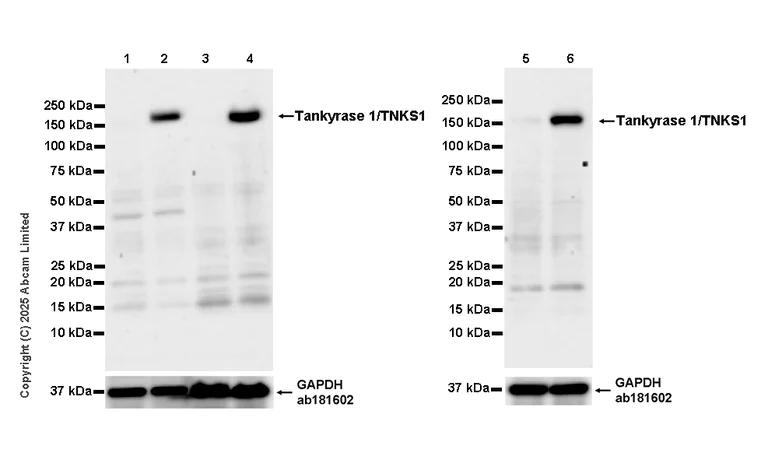 Western blot - Anti-Tankyrase 1/TNKS1 antibody [EPR29642-503] (AB324380)