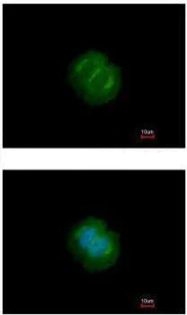 Immunocytochemistry/ Immunofluorescence - Anti-Tankyrase antibody - N-terminal (AB227469)