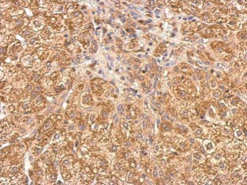 Immunohistochemistry (Formalin/PFA-fixed paraffin-embedded sections) - Anti-Tankyrase antibody - N-terminal (AB227469)