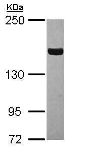 Western blot - Anti-Tankyrase antibody - N-terminal (AB227469)