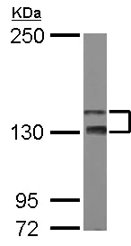 Western blot - Anti-TAOK2 antibody (AB155603)