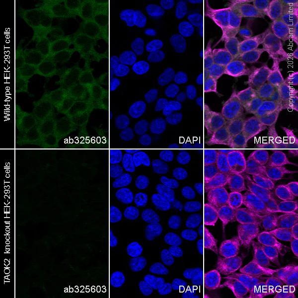 Immunocytochemistry/ Immunofluorescence - Anti-TAOK2 antibody [EPR30549-532] (AB325603)