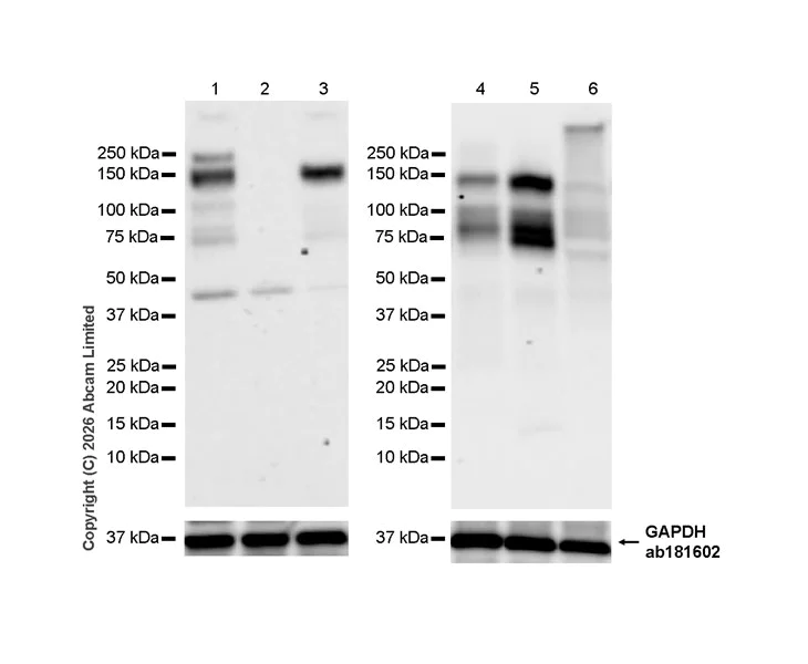 Western blot - Anti-TAOK2 antibody [EPR30549-532] (AB325603)