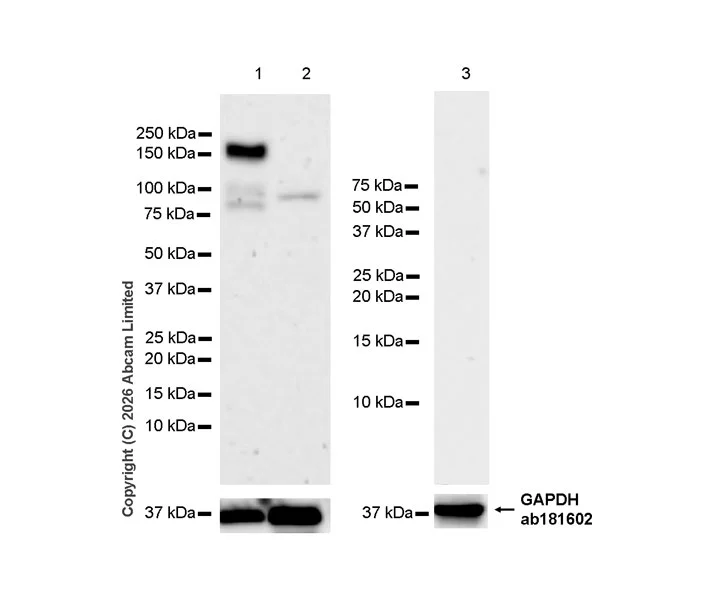 Western blot - Anti-TAOK2 antibody [EPR30549-532] (AB325603)