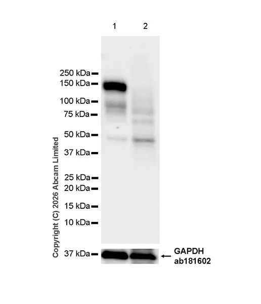 Western blot - Anti-TAOK2 antibody [EPR30549-532] (AB325603)