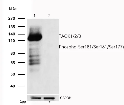 Western blot - Anti-TAOK2 (phospho S181) + TAOK1 (phospho S181) + TAOK3 (phospho S177) antibody [SR1151] (AB326667)
