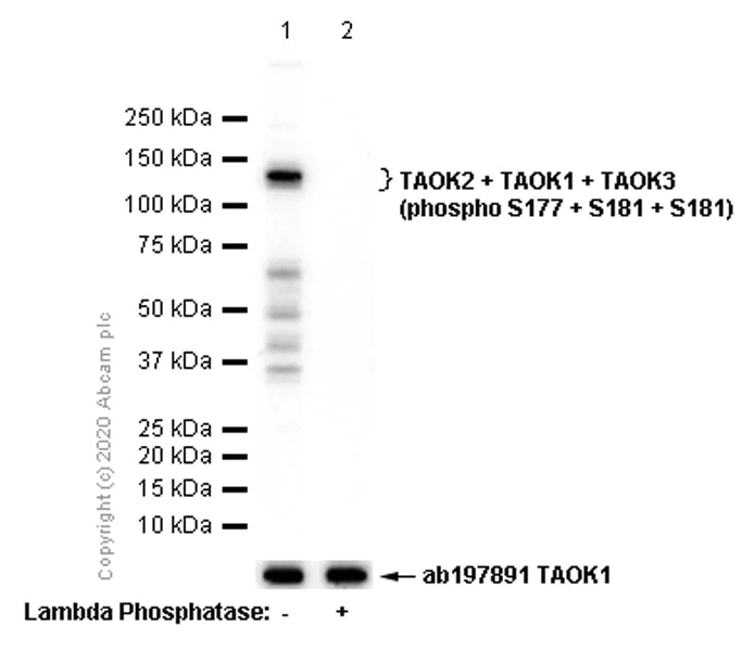 Western blot - Anti-TAOK2 + TAOK1 + TAOK3 (phospho S177 + S181 + S181) antibody [EPR4883] (AB124841)