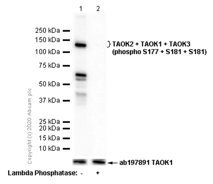 Western blot - Anti-TAOK2 + TAOK1 + TAOK3 (phospho S177 + S181 + S181) antibody [EPR4883] (AB124841)
